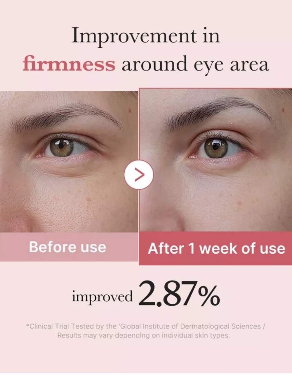 medicube PDRN Pink Peptide Eye Cream - Picture 5 of 16